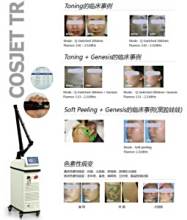 帝尔激光获得发明专利授权:“一种光斑旋转补偿激光加工方法及系统”