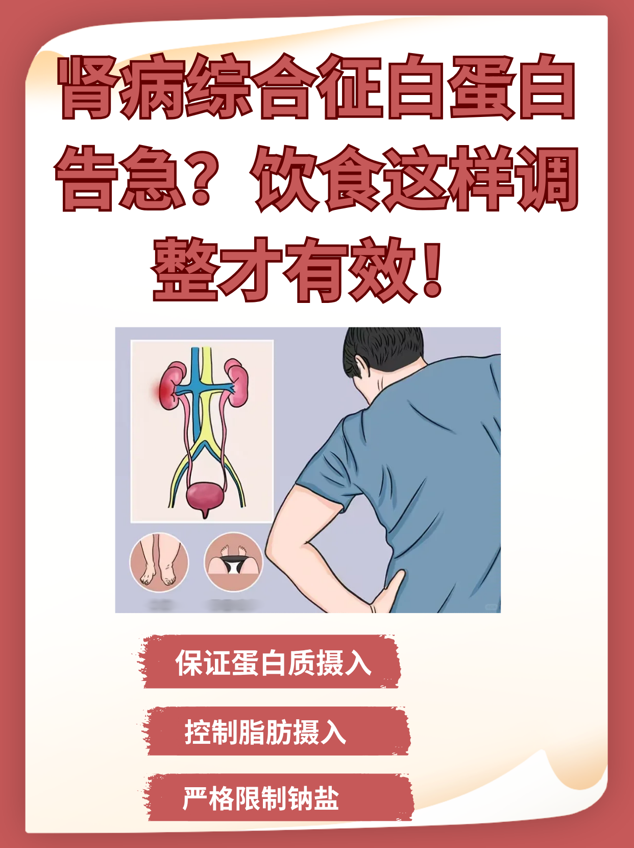 新研究：尿液白蛋白水平升高与痴呆症风险增加相关