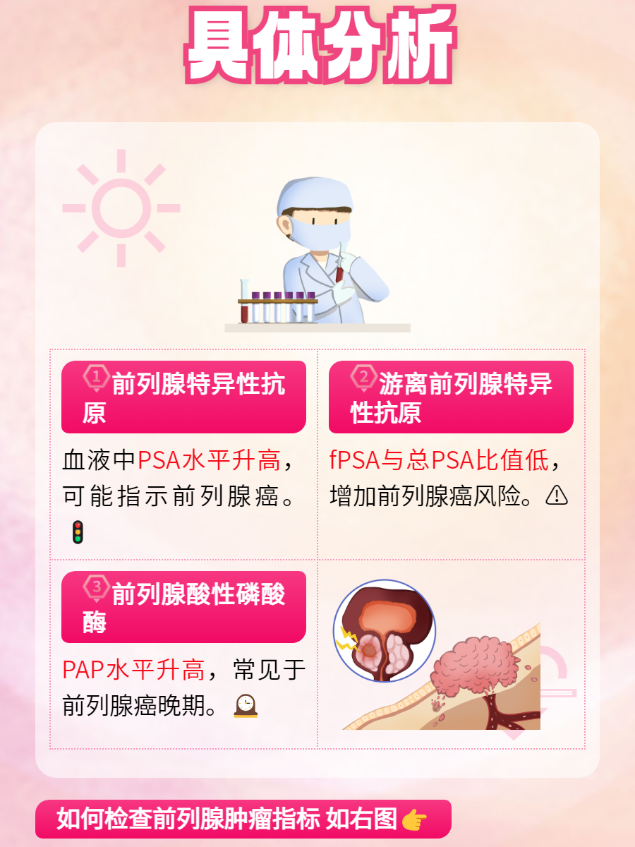 专家:前列腺癌患者应关注PSA 全程管理带来长期高质量生存