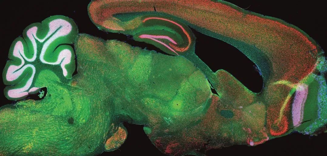 动物模型显示阿尔茨海默病或可被逆转