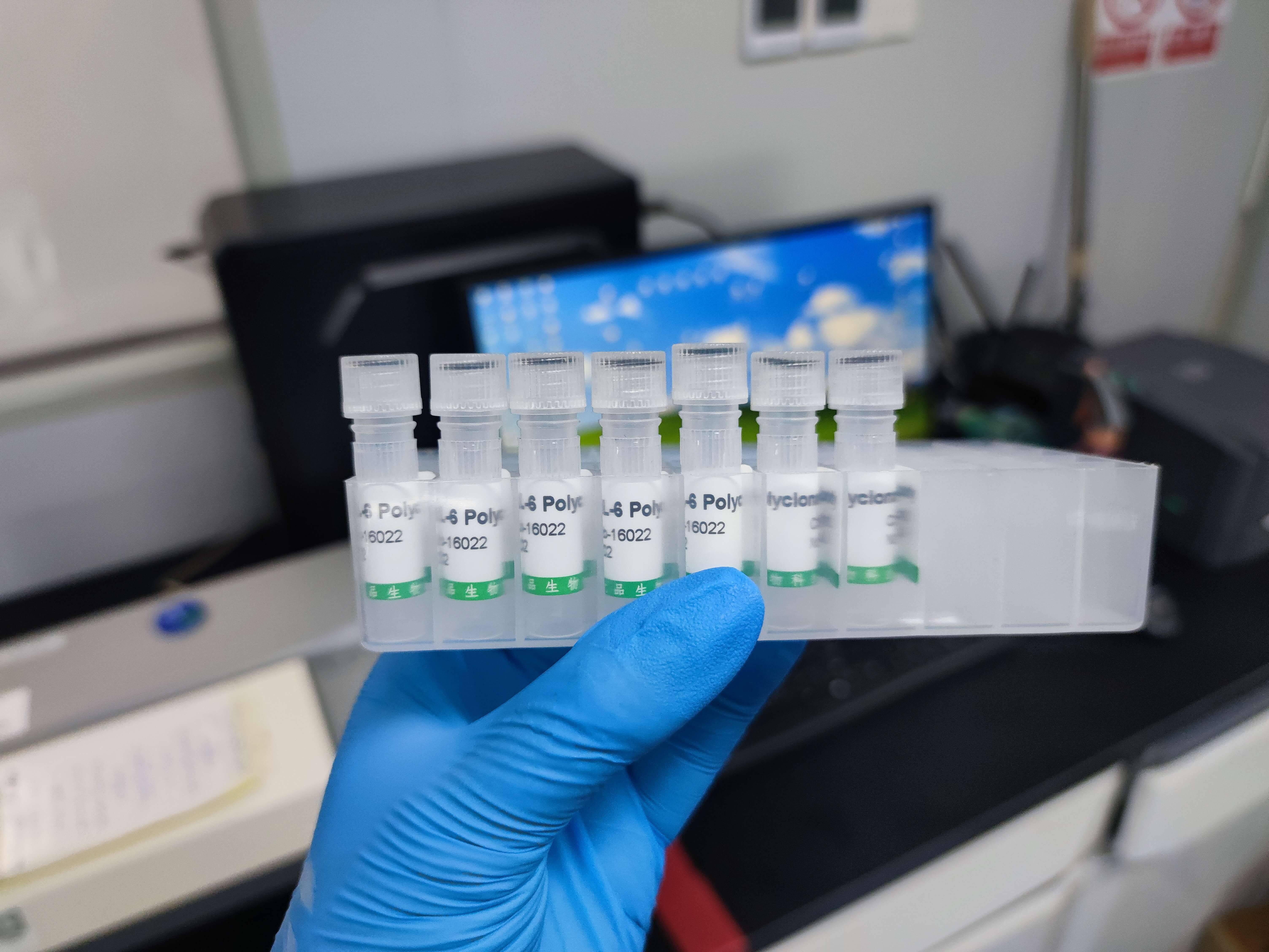 科华生物：肿瘤标志物检测试剂用于早期筛查