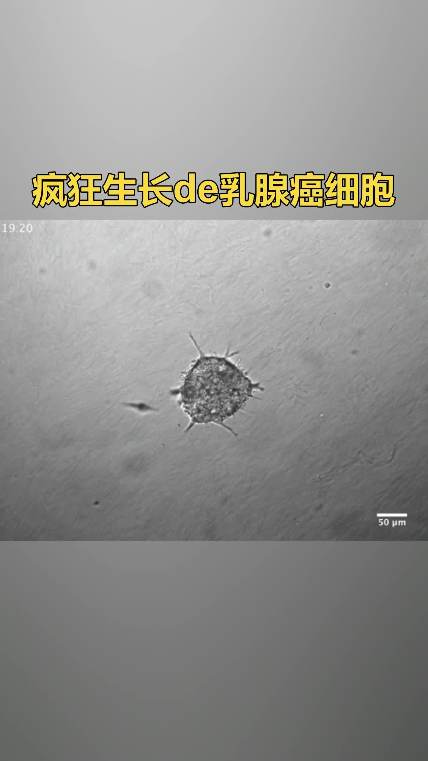 迈瑞医疗获得发明专利授权：“乳腺超声图像分割方法及设备”