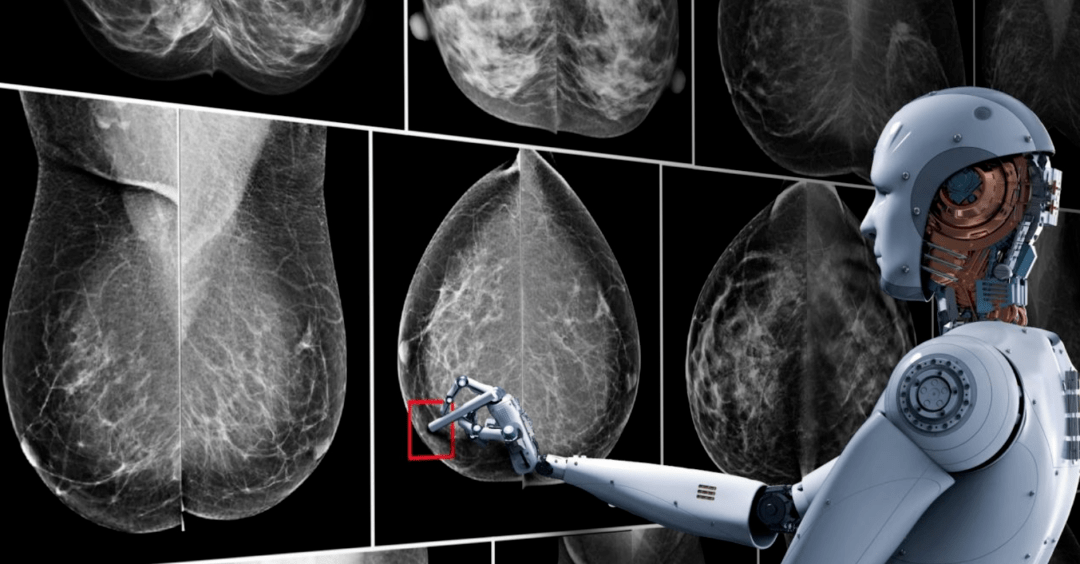 迈瑞医疗获得发明专利授权：“乳腺超声图像分割方法及设备”