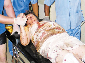 印尼巴厘岛“行李箱藏尸案”罪犯被遣返回美国