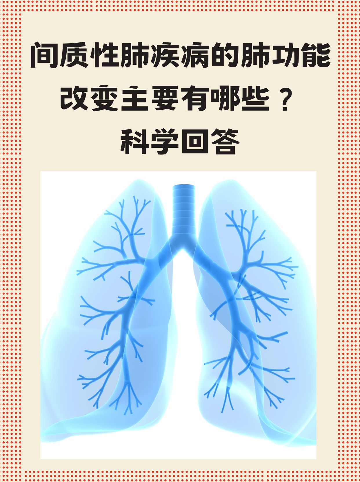 阿里健康首发石药集团抗纤维化药物伊络达® 为间质性肺病患者开辟院外新通道